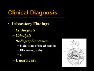 Clinical Diagnosis Laboratory Findings Leukocytosis Urinalysis Radiographic studies Plain films of the abdomen Ultrasonography CT Laparoscopy 