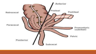 Appendicitis | PPTX