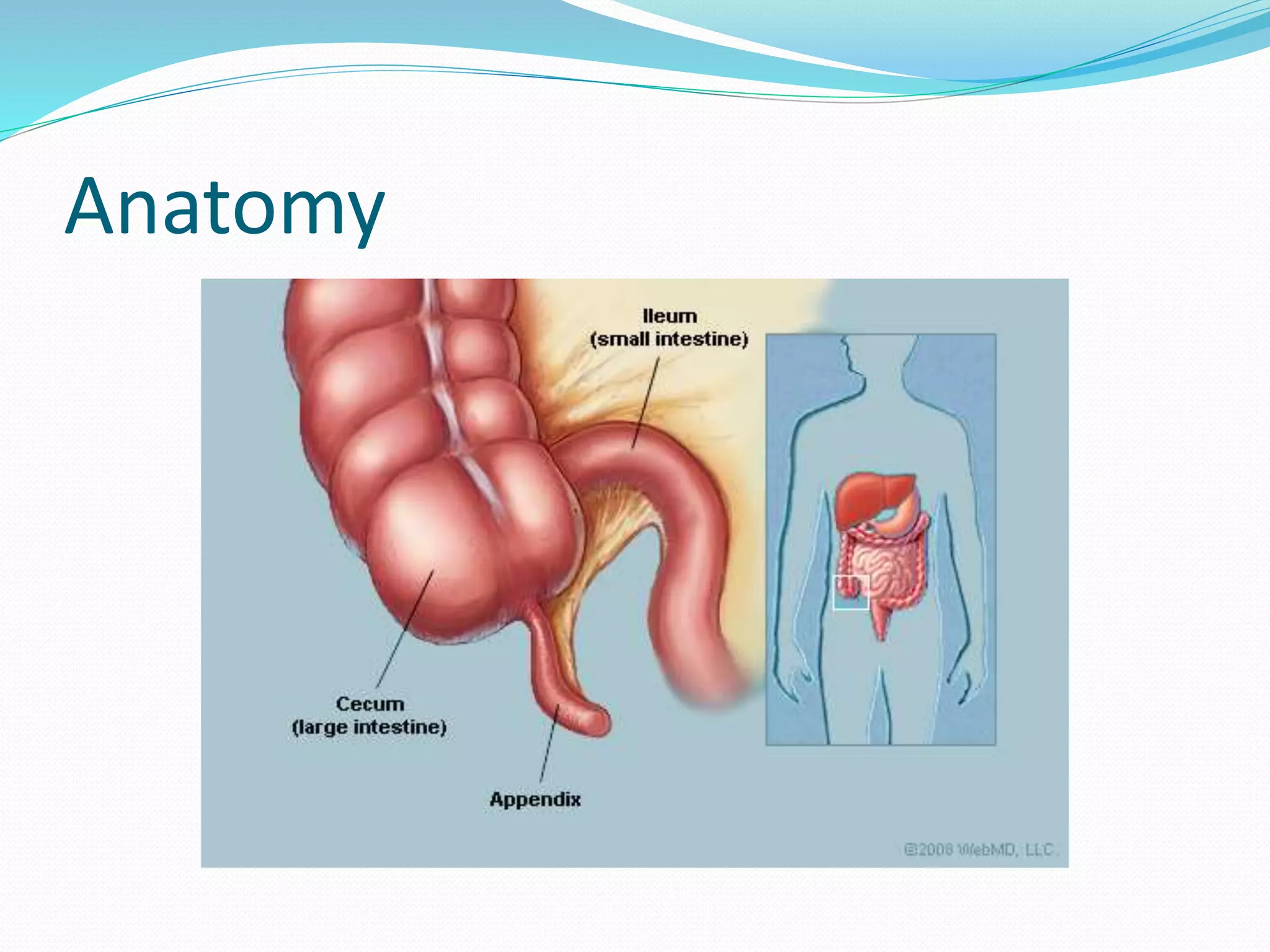Appendicitis PPT By Dr Anil Kumar, Assist Professor,Gen Surgery, AIIMS ...
