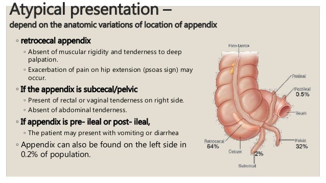presentation of appendicitis Acute appendicitis.