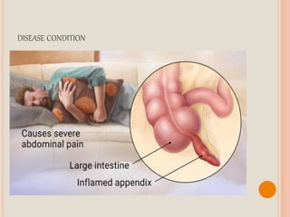 DISEASE CONDITION
 