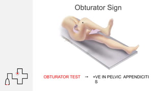 Testing Obturator Sign Obturator Test Sign
