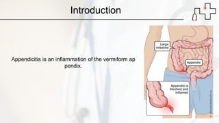 Appendicitis | PPTX