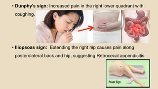 • Dunphy's sign: Increased pain in the right lower quadrant with
coughing.
• Iliopsoas sign: Extending the right hip causes pain along
posterolateral back and hip, suggesting Retrocecal appendicitis.
 