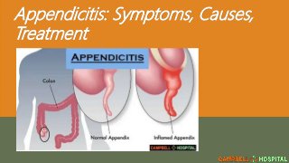Appendicitis: Symptoms, Causes,
Treatment
 