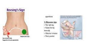 Appendicitis | PDF
