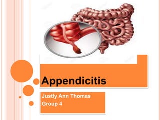 Appendicitis Symptoms Types Causes Complications 53 Off Appendicitis Symptoms Types Causes Complications 53 Off