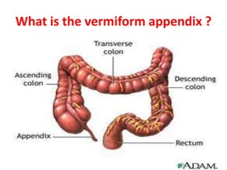APPENDICITIS.pptx