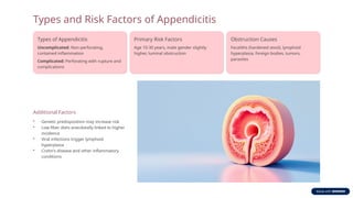 Appendicitis.pptx IN NURSING IIISEMESTER | PPTX