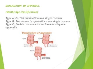full APPENDICITIS lecture-ANDREW NJAMBA .pptx