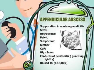 Appendicitis- a simplistic view for GPs | PPTX