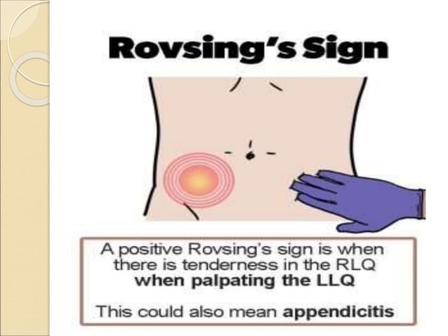 APPENDICITIS clinical sign symptoms and Management.ppt