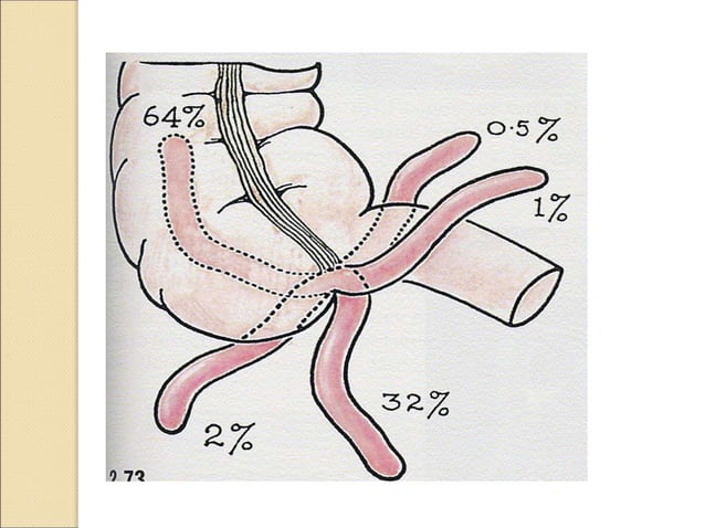 APPENDICITIS clinical sign symptoms and Management.ppt