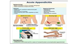 Acute APPENDICITIS internal medicine .pptx