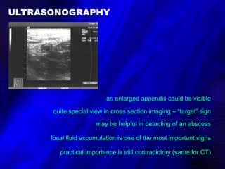 Target. Sign Appencitis Appendicitis DELV.ppt