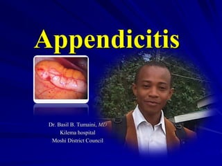 Appendicitis
Dr. Basil B. Tumaini, MD
Kilema hospital
Moshi District Council
 