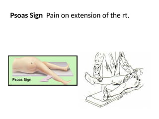 Psoas Sign Pain on extension of the rt. thigh
 