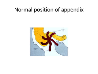 Normal position of appendix
 