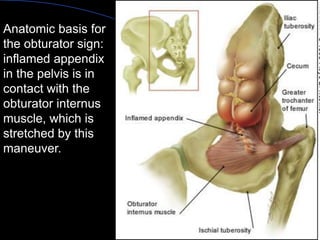 Anatomic basis for the obturator sign: inflamed appendix in the pelvis is in contact with the obturator internus muscle, which is stretched by this maneuver. 
Aboubakr Elnashar  