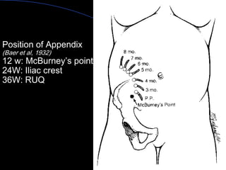 Position of Appendix (Baer et al, 1932) 12 w: McBurney’s point 24W: Iliac crest 36W: RUQ 
Aboubakr Elnashar  