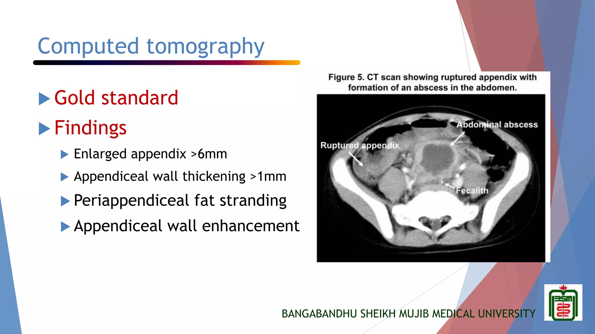 Appendicitis in children | PPTX