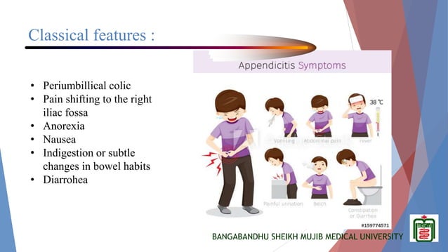 Appendicitis in children | PPTX