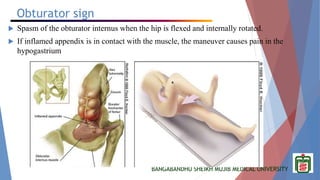 BANGABANDHU SHEIKH MUJIB MEDICAL UNIVERSITY
Obturator sign
 Spasm of the obturator internus when the hip is flexed and internally rotated.
 If inflamed appendix is in contact with the muscle, the maneuver causes pain in the
hypogastrium
 