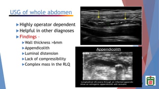 BANGABANDHU SHEIKH MUJIB MEDICAL UNIVERSITY
USG of whole abdomen
Highly operator dependent
Helpful in other diagnoses
Findings –
Wall thickness >6mm
Appendicolith
Luminal distension
Lack of compressibility
Complex mass in the RLQ
 