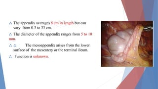 Overview of Appendicitis in Children:.pptx