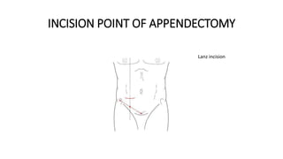 APPENDICITIS power point presentations.pptx