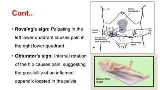 Appendicitis | PPTX