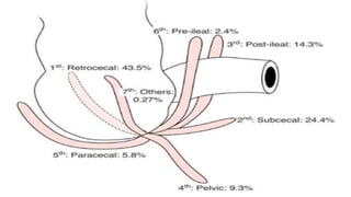 Appendicitis | PPTX