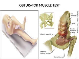 ACUTE APPENDICITIS PPT [Autosaved].pptx