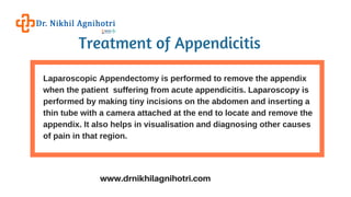 Appendicitis treatment In New Delhi | Laparoscopic Appendectomy In ...