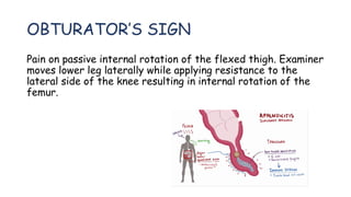 OBTURATOR’S SIGN
Pain on passive internal rotation of the flexed thigh. Examiner
moves lower leg laterally while applying resistance to the
lateral side of the knee resulting in internal rotation of the
femur.
 