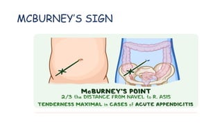MCBURNEY’S SIGN
 