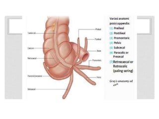 Appendix Mass Appendiceitis, Appendecular mass and appendicular diseases .pptx