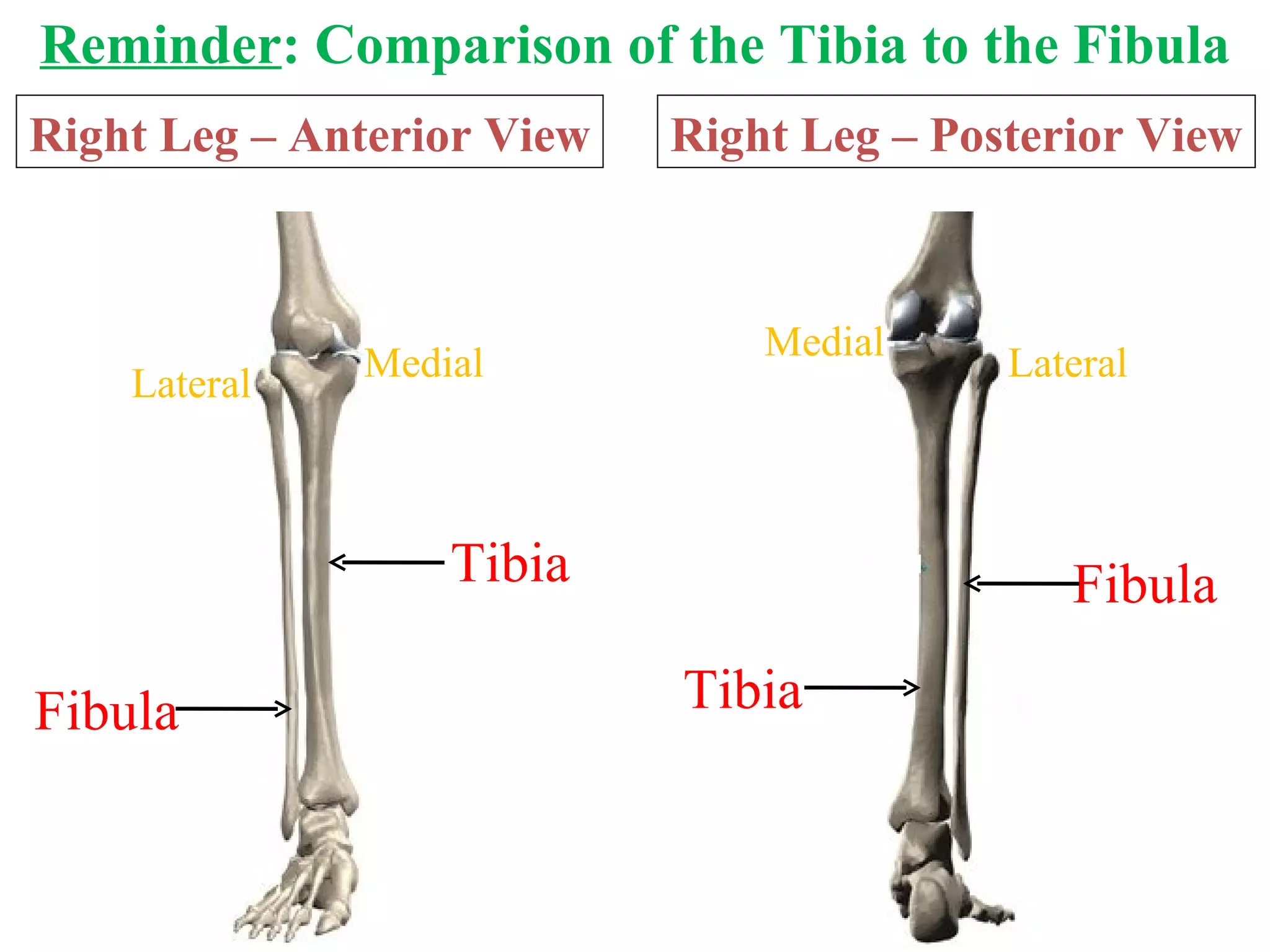 Reminder : Comparison of the Tibia to the Fibula Right Leg – Anterior View Tibia Fibula Lateral Medial Right Leg – Posterior View Fibula Tibia Lateral Medial 