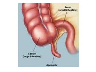 Appendix | PPTX
