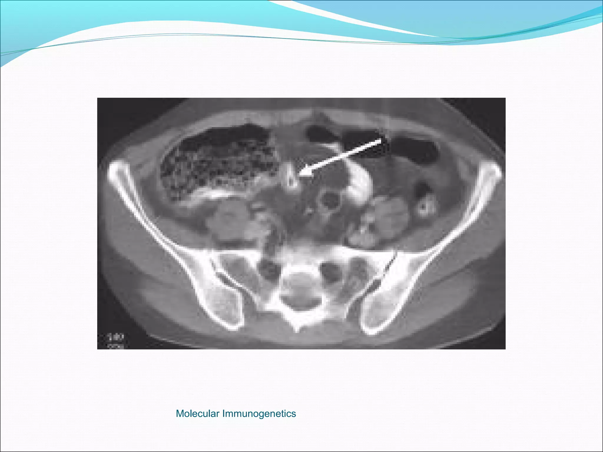 Molecular Immunogenetics
 