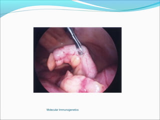 Molecular Immunogenetics
 