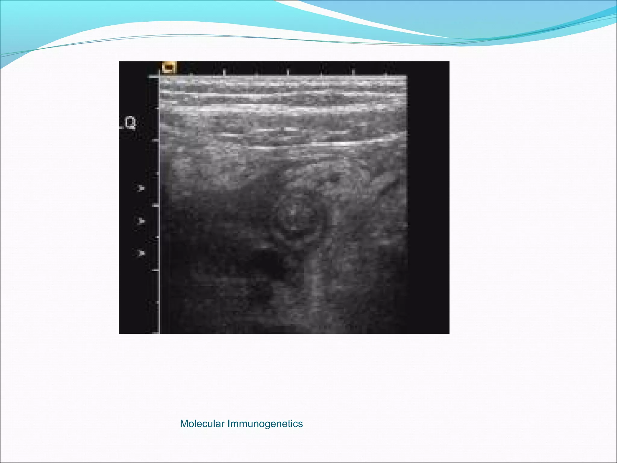 Molecular Immunogenetics
 