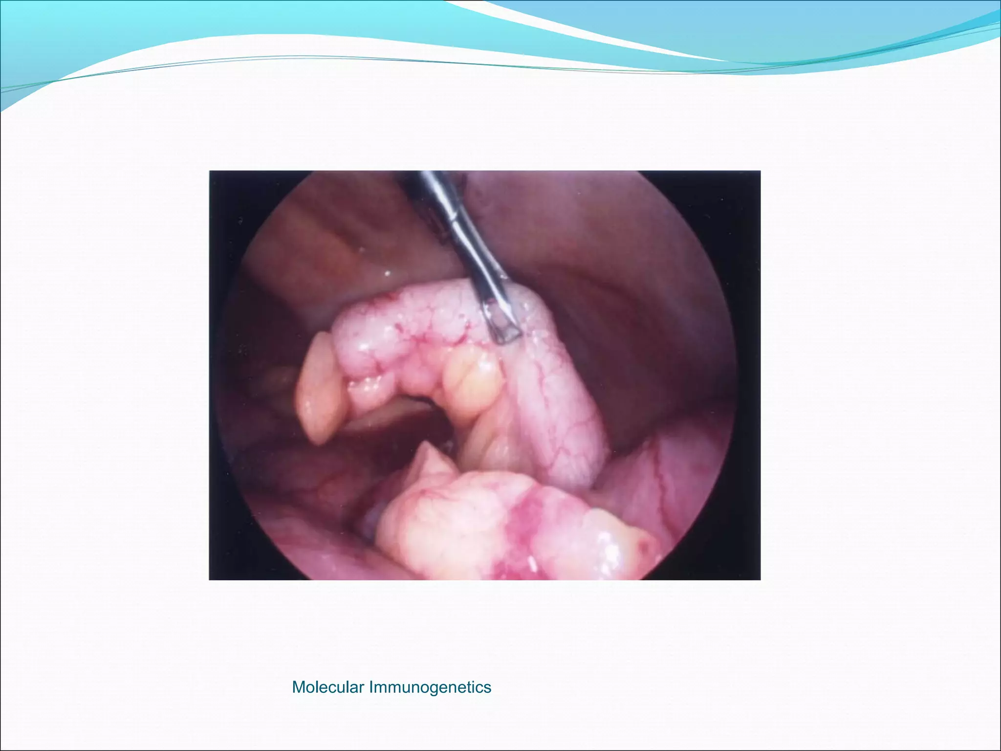 Molecular Immunogenetics
 