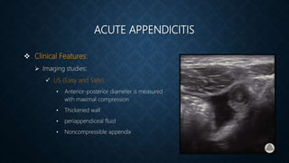 ACUTE APPENDICITIS
 Clinical Features:
 Imaging studies:
 US (Easy and Safe):
• Anterior-posterior diameter is measured
with maximal compression
• Thickened wall
• periappendiceal fluid
• Noncompressible appendix
 
