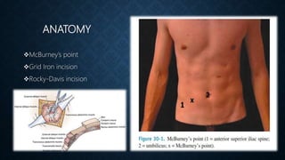 ANATOMY
McBurney’s point
Grid Iron incision
Rocky-Davis incision
 
