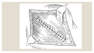 Excised Appendix appendix and its diseases in detail for surgery | PPTX