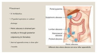 appendix and its diseases in detail for surgery | PPTX
