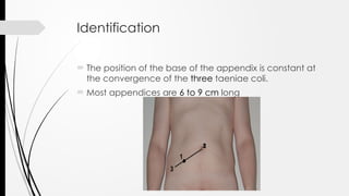 Appendix - Anatomy Physiology and Appendicitis | PPTX