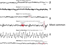 β
α
θ
Most common
δ
 