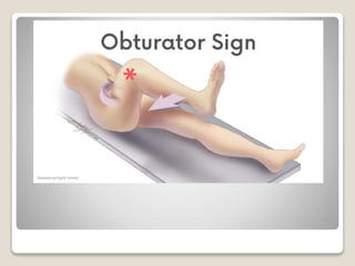 Testing Obturator Sign Obturator Sign